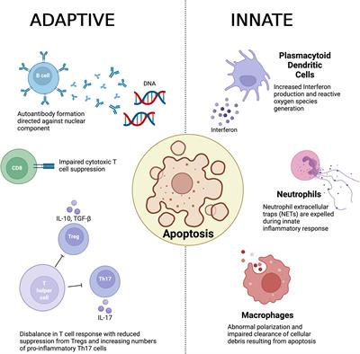 The Role of Immunometabolism in the Pathogenesis of Systemic Lupus Erythematosus